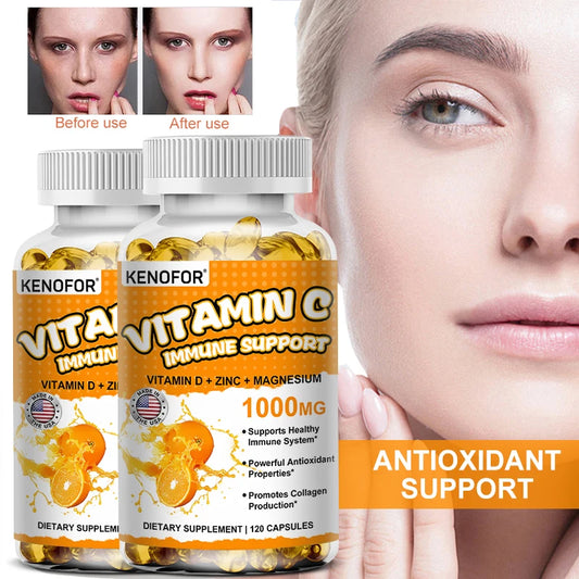 Vitamin C Supplement - Antioxidant, Promotes Collagen Production and Skin Health Essential Nutrient To Support Immune Health